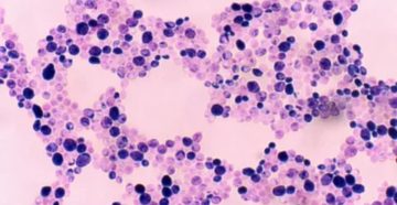 Степень критичности микроорганизмов: 1-Neisseria subflava 10^5, 2-Candida albicans 10^3 Степень критичности микроорганизмов: 1-Neisseria subflava 10^5, 2-Candida albicans 10^3