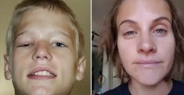 Не проходят отеки лица после гайморита Не проходят отеки лица после гайморита