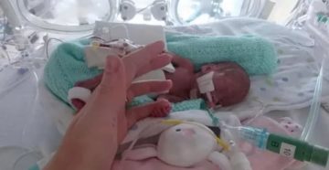 Преждевременные роды в 22 недели