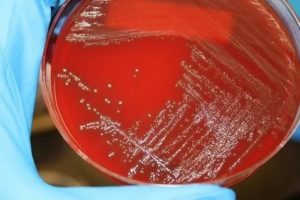 Посев из эякулята streptococcus mitis и streptococcus mitis