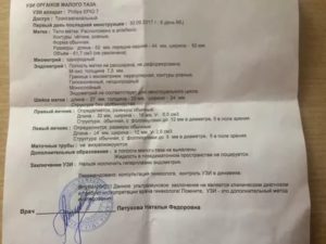 Можно ли делать УЗИ малого таза раньше, чем 5 день цикла