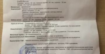 Можно ли делать УЗИ малого таза раньше, чем 5 день цикла