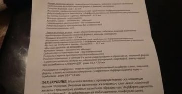 Протокол маммографии: Тени негомогенных лимфатических узлов в зоргиевских зонах