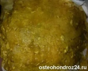 Лечение стафилококка и дисбактериоза у грудничка