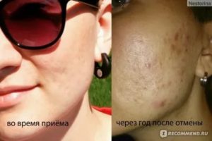 Последствия отмены ок после 1 месяца приема