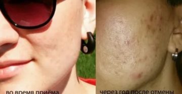 Последствия отмены ок после 1 месяца приема