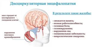 Энцефалопатия