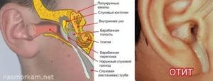 Боль в горле отдающая в ухо