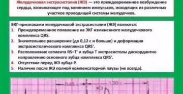 Экстрасистолия при приеме карведилола