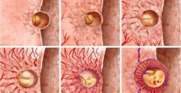 Кровит после ЭКО