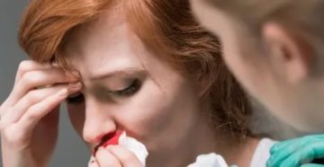 Назонекс и кровотечение из носа