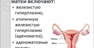 Боли в области матки от норколута