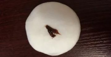 Коричневые сгустки за неделю до месячных