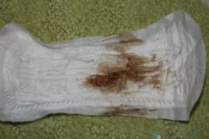 Коричневые выделения в середине цикла без боли и запаха