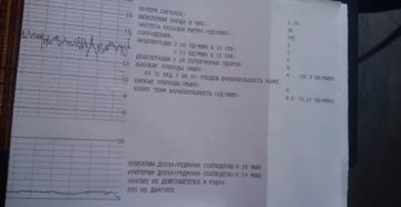 Расшифровка ктг на 32 недели у 73,8% плодов вариабельность ниже
